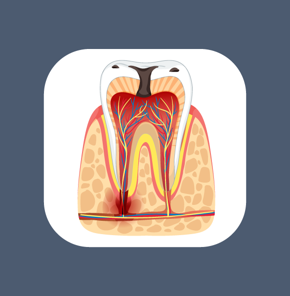 Endodonti